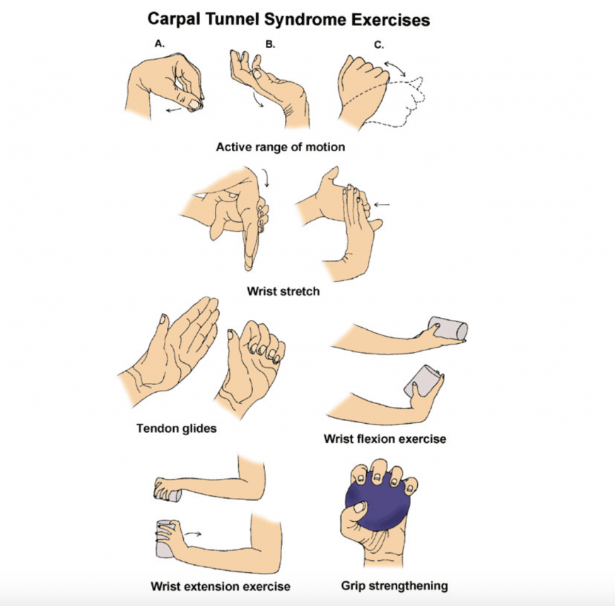 Carpal tunnel syndrome hand exercises for pregnant women in Dubai Carpal tunnel syndrome hand exercises for pregnant women in Dubai